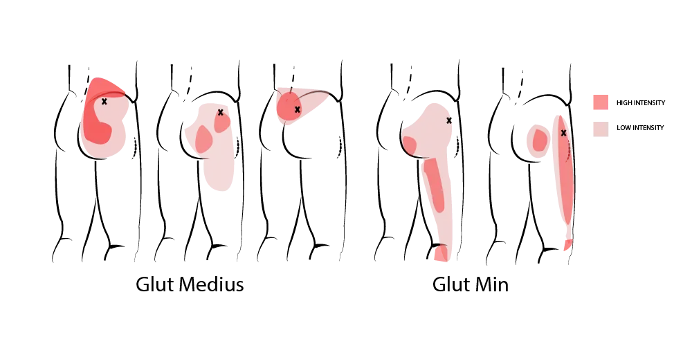 sciatica flase types osteopthic treatment wimbledon