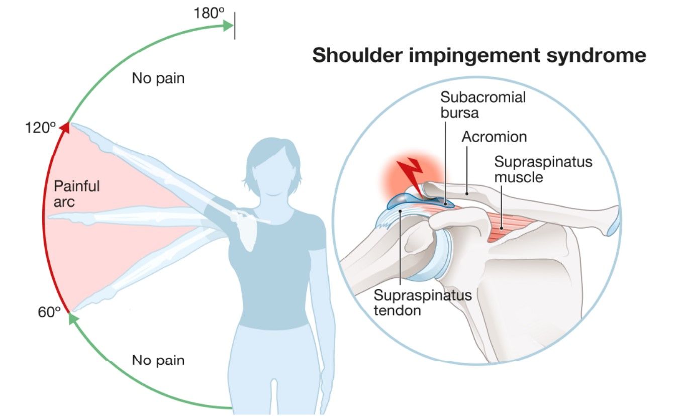 Understanding Differential Diagnoses