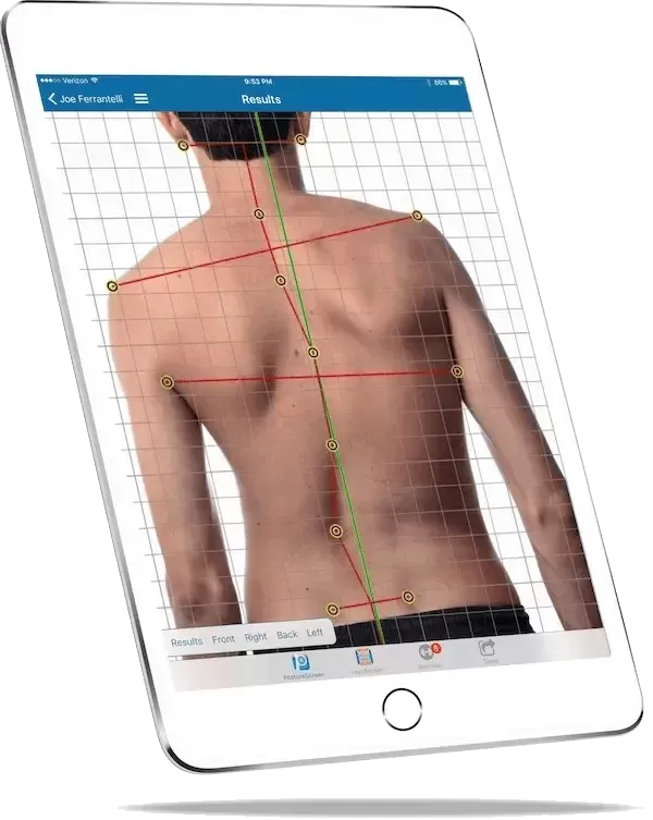 postural screen scan with osteopath in wimbledon